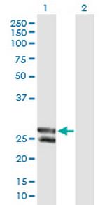MGC50559 Antibody in Western Blot (WB)