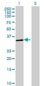 OR52B2 Antibody in Western Blot (WB)