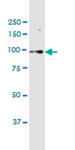 C15orf55 Antibody in Western Blot (WB)