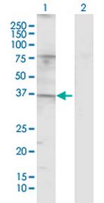 TAS2R49 Antibody in Western Blot (WB)