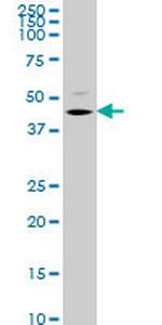 STK32C Antibody in Western Blot (WB)