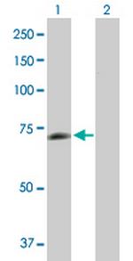 PGM2L1 Antibody in Western Blot (WB)