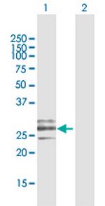 CLEC9A Antibody in Western Blot (WB)