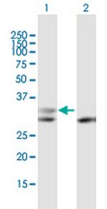 PGP Antibody in Western Blot (WB)