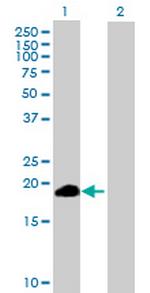 ZSCAN1 Antibody in Western Blot (WB)