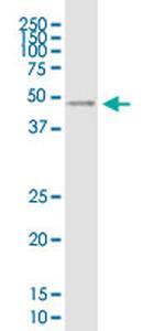 VSTM1 Antibody in Western Blot (WB)