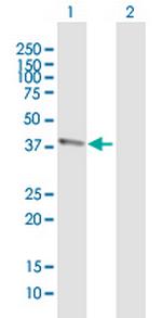 BTBD8 Antibody in Western Blot (WB)