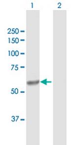 CYP4V2 Antibody in Western Blot (WB)