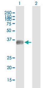 MGC34713 Antibody in Western Blot (WB)