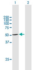 PNPLA1 Antibody in Western Blot (WB)