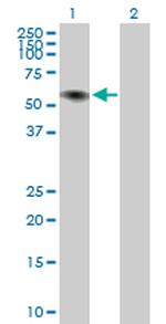 ILDR1 Antibody in Western Blot (WB)