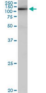 SALF Antibody in Western Blot (WB)