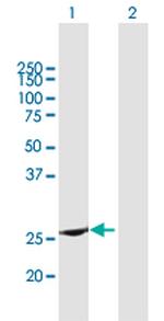 RAB37 Antibody in Western Blot (WB)