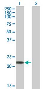 RAB7B Antibody in Western Blot (WB)