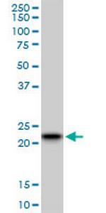 RAB7B Antibody in Western Blot (WB)