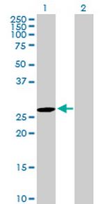 DUPD1 Antibody in Western Blot (WB)