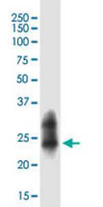 RAB43 Antibody in Western Blot (WB)