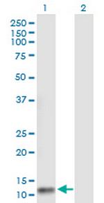 FLJ37478 Antibody in Western Blot (WB)