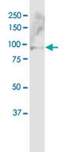 ABCB5 Antibody in Western Blot (WB)