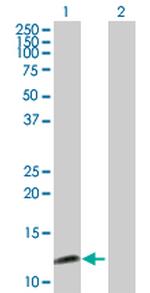 SYCN Antibody in Western Blot (WB)