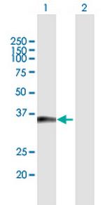 TICAM2 Antibody in Western Blot (WB)