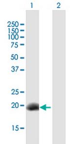 DPPA3 Antibody in Western Blot (WB)