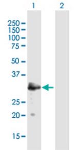 MAST4 Antibody in Western Blot (WB)