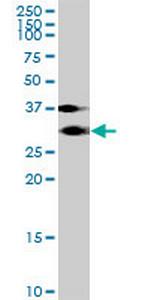 KCTD4 Antibody in Western Blot (WB)