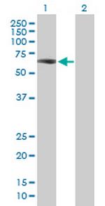 ZNF307 Antibody in Western Blot (WB)