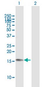 C16orf85 Antibody in Western Blot (WB)