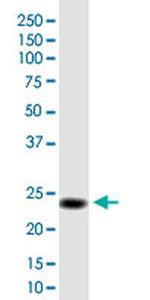 C2orf27B Antibody in Western Blot (WB)