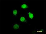 BRCC2 Antibody in Immunocytochemistry (ICC/IF)