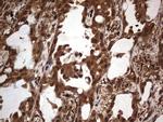 H2AFY2 Antibody in Immunohistochemistry (Paraffin) (IHC (P))