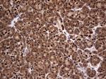 H2AFY2 Antibody in Immunohistochemistry (Paraffin) (IHC (P))