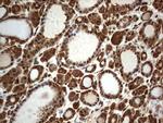 H2AFY2 Antibody in Immunohistochemistry (Paraffin) (IHC (P))