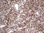 H2AFY2 Antibody in Immunohistochemistry (Paraffin) (IHC (P))