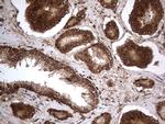 H2AFY2 Antibody in Immunohistochemistry (Paraffin) (IHC (P))