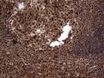 H2AFY2 Antibody in Immunohistochemistry (Paraffin) (IHC (P))