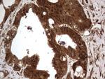 H2AFY2 Antibody in Immunohistochemistry (Paraffin) (IHC (P))