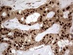 H2AFY2 Antibody in Immunohistochemistry (Paraffin) (IHC (P))