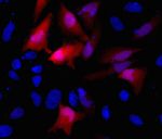 HA Tag Antibody in Immunocytochemistry (ICC/IF)