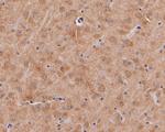 Dopamine Transporter Antibody in Immunohistochemistry (Paraffin) (IHC (P))