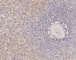 ME2 Antibody in Immunohistochemistry (Paraffin) (IHC (P))