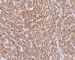 ME2 Antibody in Immunohistochemistry (Paraffin) (IHC (P))