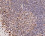 ME2 Antibody in Immunohistochemistry (Paraffin) (IHC (P))