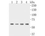 ME2 Antibody in Western Blot (WB)