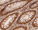 MAT2A Antibody in Immunohistochemistry (Paraffin) (IHC (P))