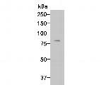 Complement factor B Antibody in Western Blot (WB)