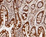 Nucleoside Phosphorylase Antibody in Immunohistochemistry (Paraffin) (IHC (P))