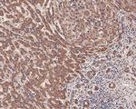 LIPF Antibody in Immunohistochemistry (Paraffin) (IHC (P))